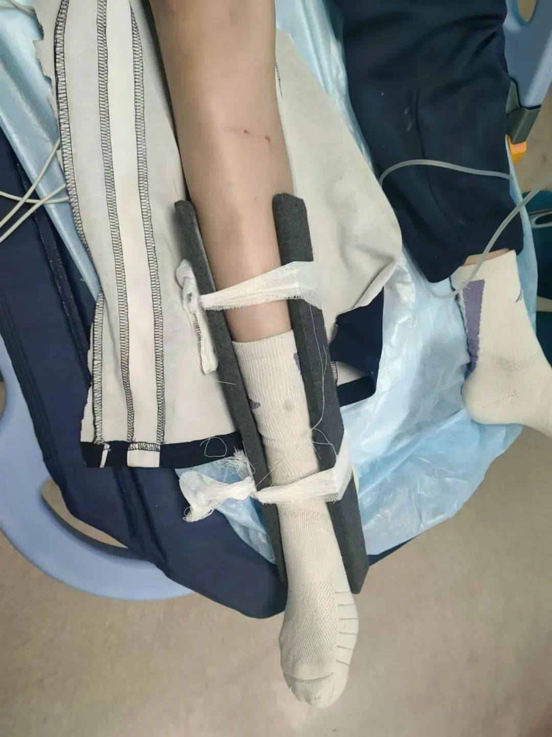 惨痛<strong></p>
<p>gxs币行情</strong>！一人身亡！深圳多名学生骑电动车发生意外