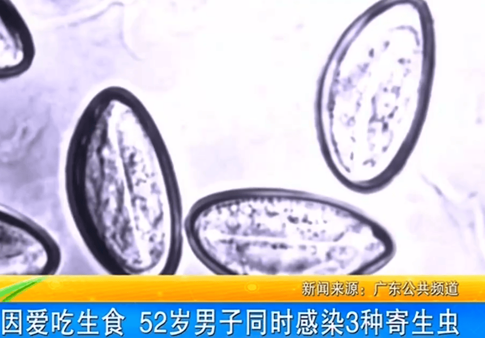 女子体内排出10米长绦虫<strong></p>
<p>比特币价格回落</strong>！原是两年前旅游时吃了这种食物