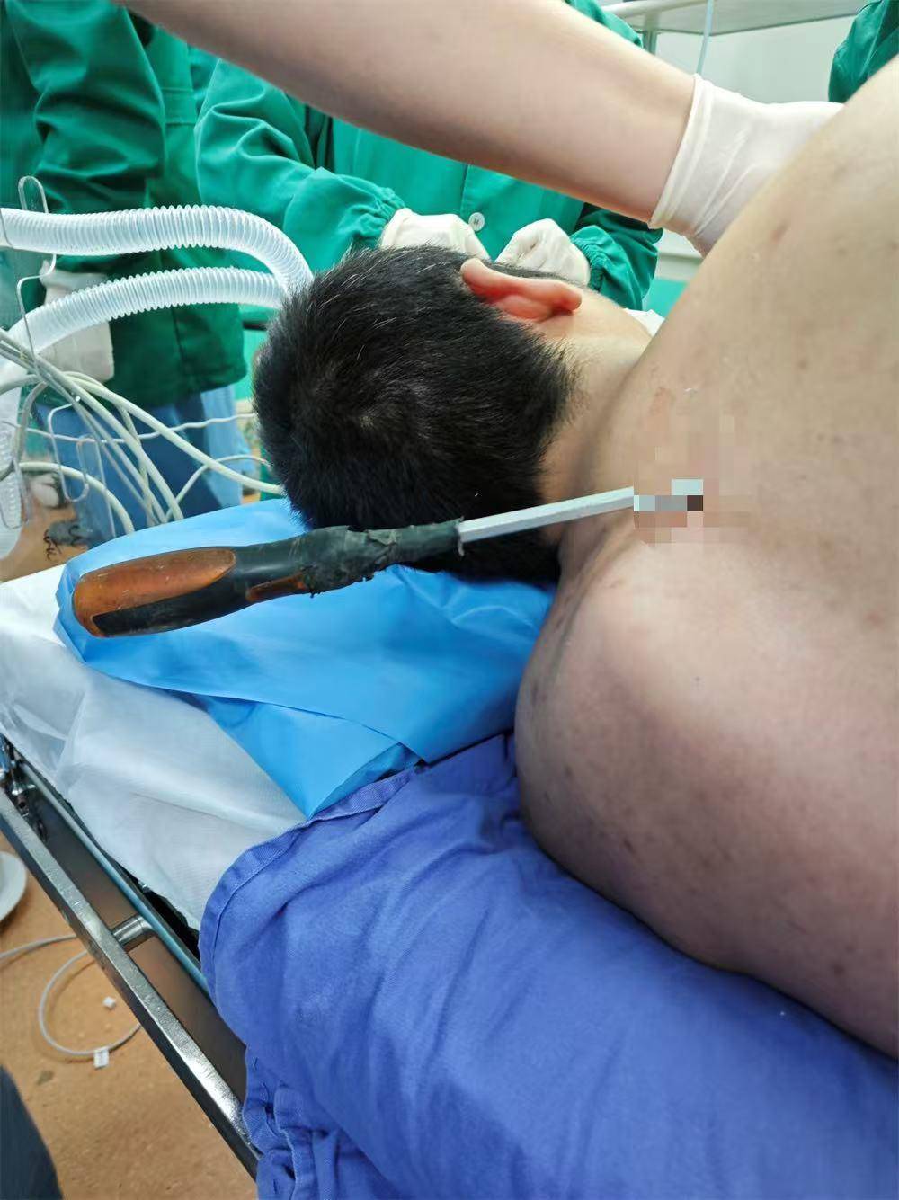 20米高空掉落螺丝刀直插男子胸腔<strong></p>
<p>原油市场分析</strong>！医生：不要自行拔除