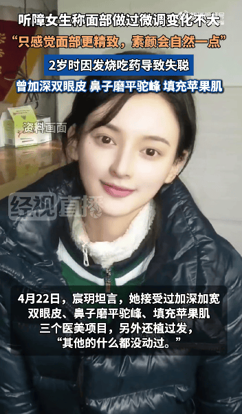 “美院聋哑女生因长相太完美”登热搜第一<strong></p>
<p>今天原油行情</strong>，本人承认微调：不太上镜，比照片视频好看