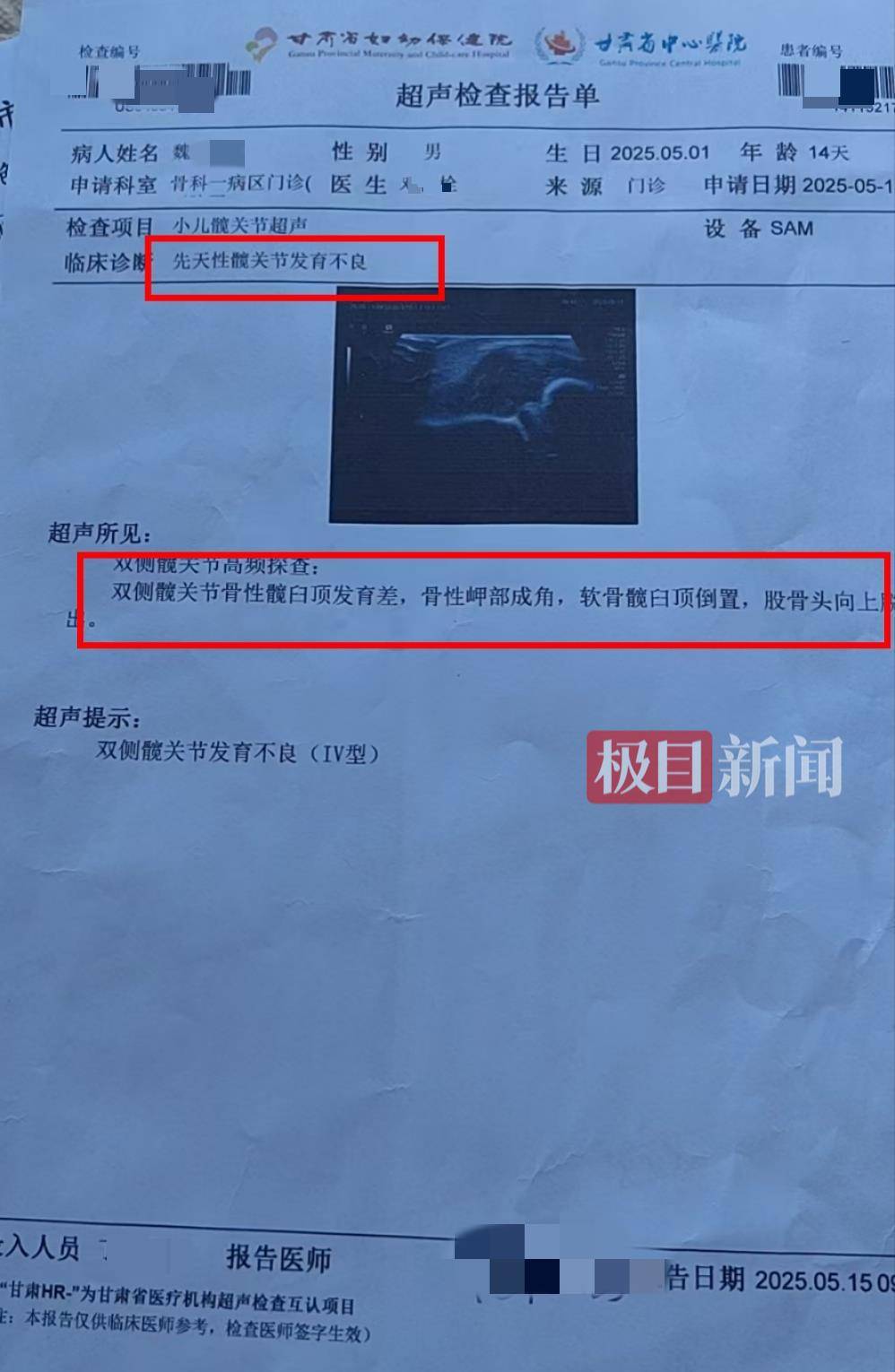 二胎出生查出先天性病症或落下残疾<strong></p>
<p>荣原油</strong>，残疾父母称医院产检漏检、未尽告知义务，医院及医调委回应
