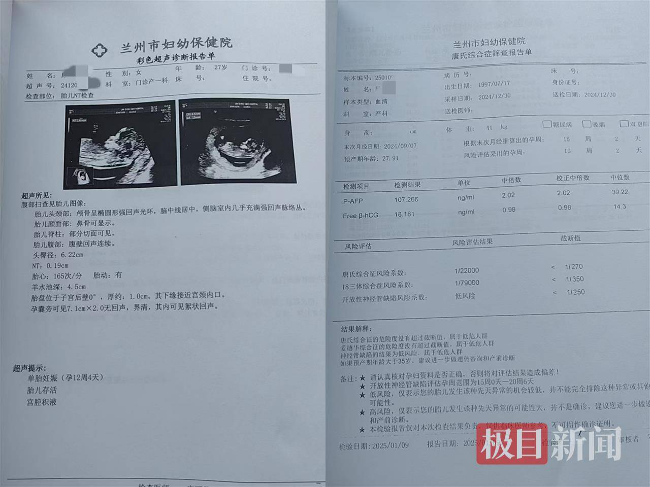 二胎出生查出先天性病症或落下残疾<strong></p>
<p>荣原油</strong>，残疾父母称医院产检漏检、未尽告知义务，医院及医调委回应