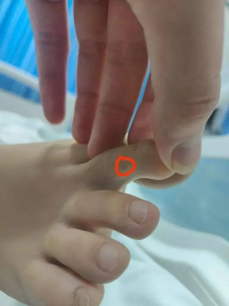 紧急转院仍无力回天<strong></p>
<p>荣原油</strong>！三亚蛇咬事件暴露旅游安全漏洞