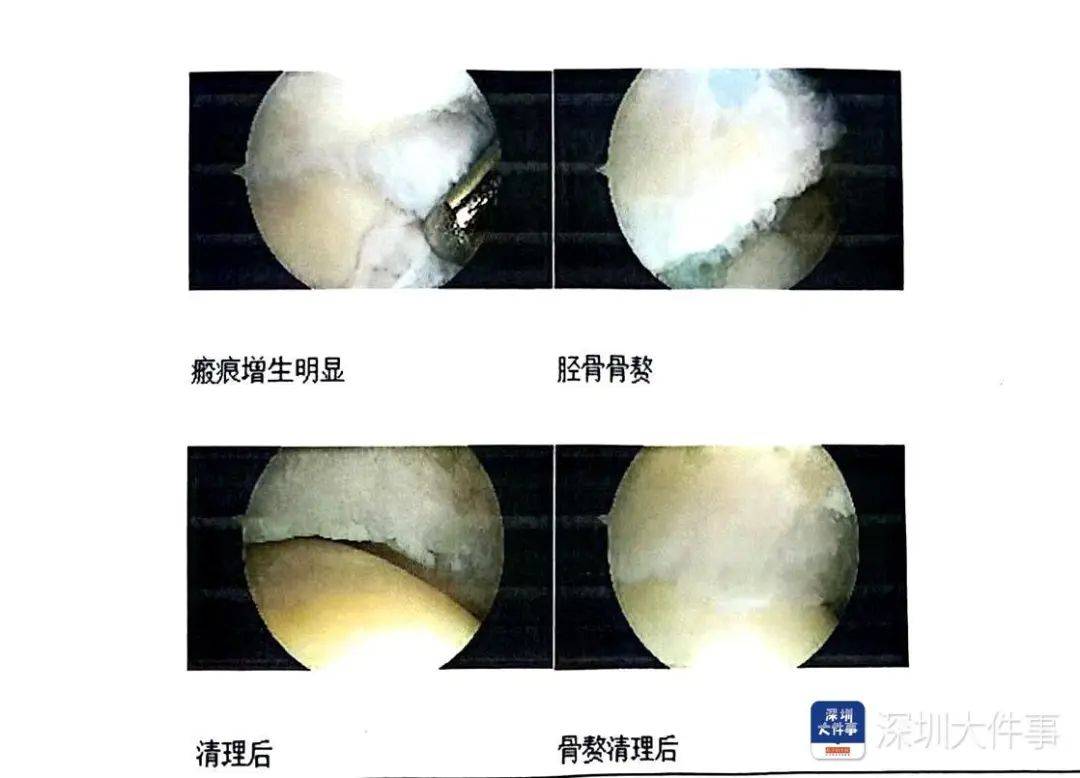 “一走路就痛”！女子脚踝受伤遭漏诊<strong></p>
<p>新浪原油期货</strong>，治了7年没好！深圳一医院被告上法庭