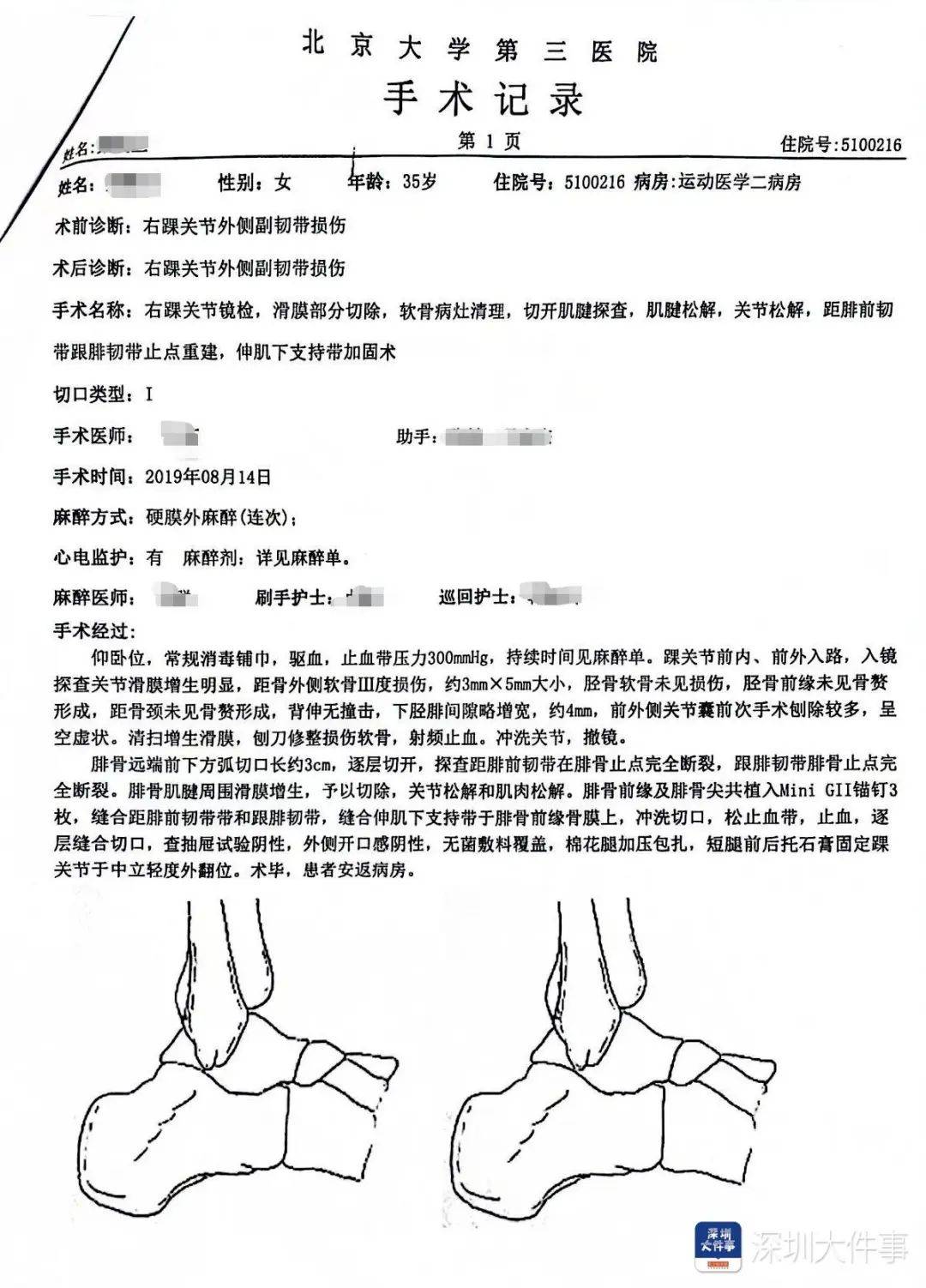 “一走路就痛”！女子脚踝受伤遭漏诊<strong></p>
<p>新浪原油期货</strong>，治了7年没好！深圳一医院被告上法庭