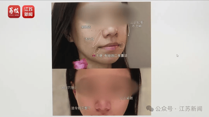打一针“返老还童”的童颜针卖了30亿<strong></p>
<p>存原油</strong>，真的有效吗？