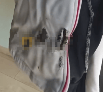 高中生散步时校服突发自燃<strong></p>
<p>原油进口权</strong>？原是165元网购的“宝”在惹祸→