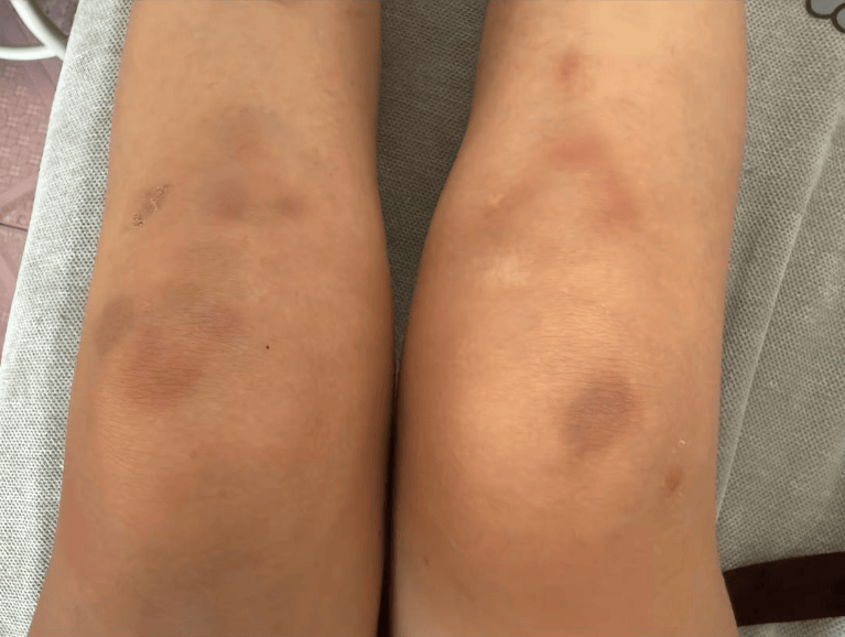 女子自称因工资问题被老板锁办公室里打 警方:双方已到派出所<strong></p>
<p>爬虫</strong>,是否打人还在调查