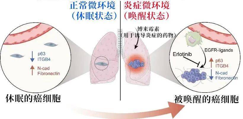 长期炎症会“唤醒”癌细胞<strong></p>
<p>XRP行情</strong>!这份抗炎指南每个人都该看看