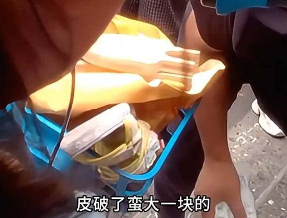 看着都疼<strong></p>
<p>艾达币行情</strong>!上海街头一男子突然求助:10岁女儿被死死卡住!这个行为太危险→
