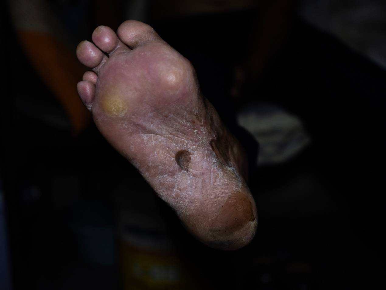 <strong></p>
<p>区块链挖矿行情</strong>他们挤在8元一晚的旅店 几百人抢一个活