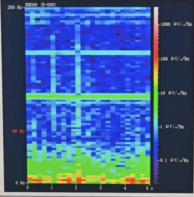 山西首例<strong></p>
<p>BITOP价格</strong>!山西省人民医院成功实施脑机接口辅助功能区脑肿瘤切除手术