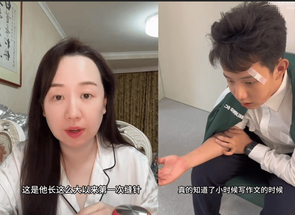 演员关凌用一次性针头为儿子挑痘 致其面部缝了四针