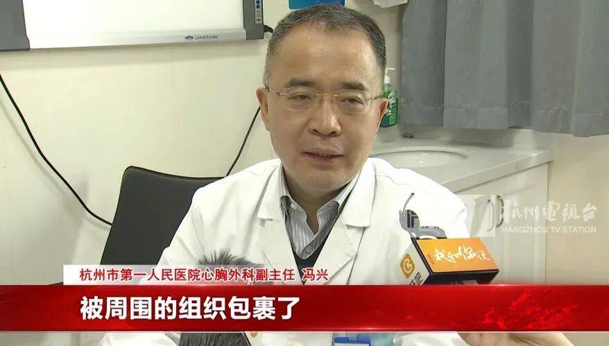 17岁小伙参军体检发现胸腔内有根5cm缝衣针<strong></p>
<p>虚拟货币ico</strong>，父母回忆或是1岁时扎入，取出时已锈迹斑斑